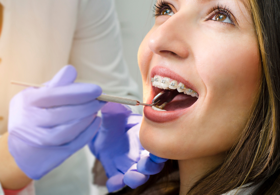 Where can I get braces in Pflugerville ,Where can I get braces in North Austin?